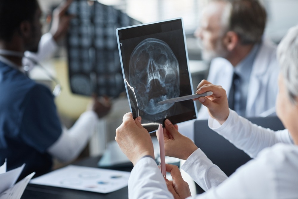Medical professionals discussing a skull X-ray on a tablet while evaluating a traumatic brain injury case